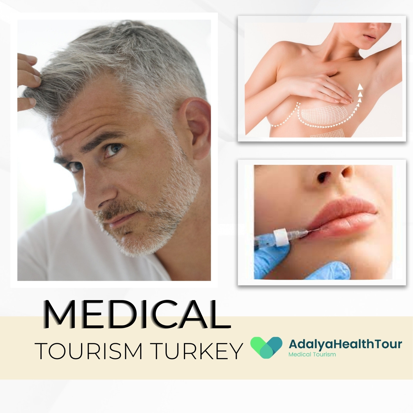 medical-tourism-in-turkey-antalya-istanbul-health-plastic-surgery-prices-packages-cosmetic-healthcare-companies-agency-cost-global-turkish medical tourism in turkey antalya istanbul health plastic surgery prices packages cosmetic healthcare companies agency cost global turkish